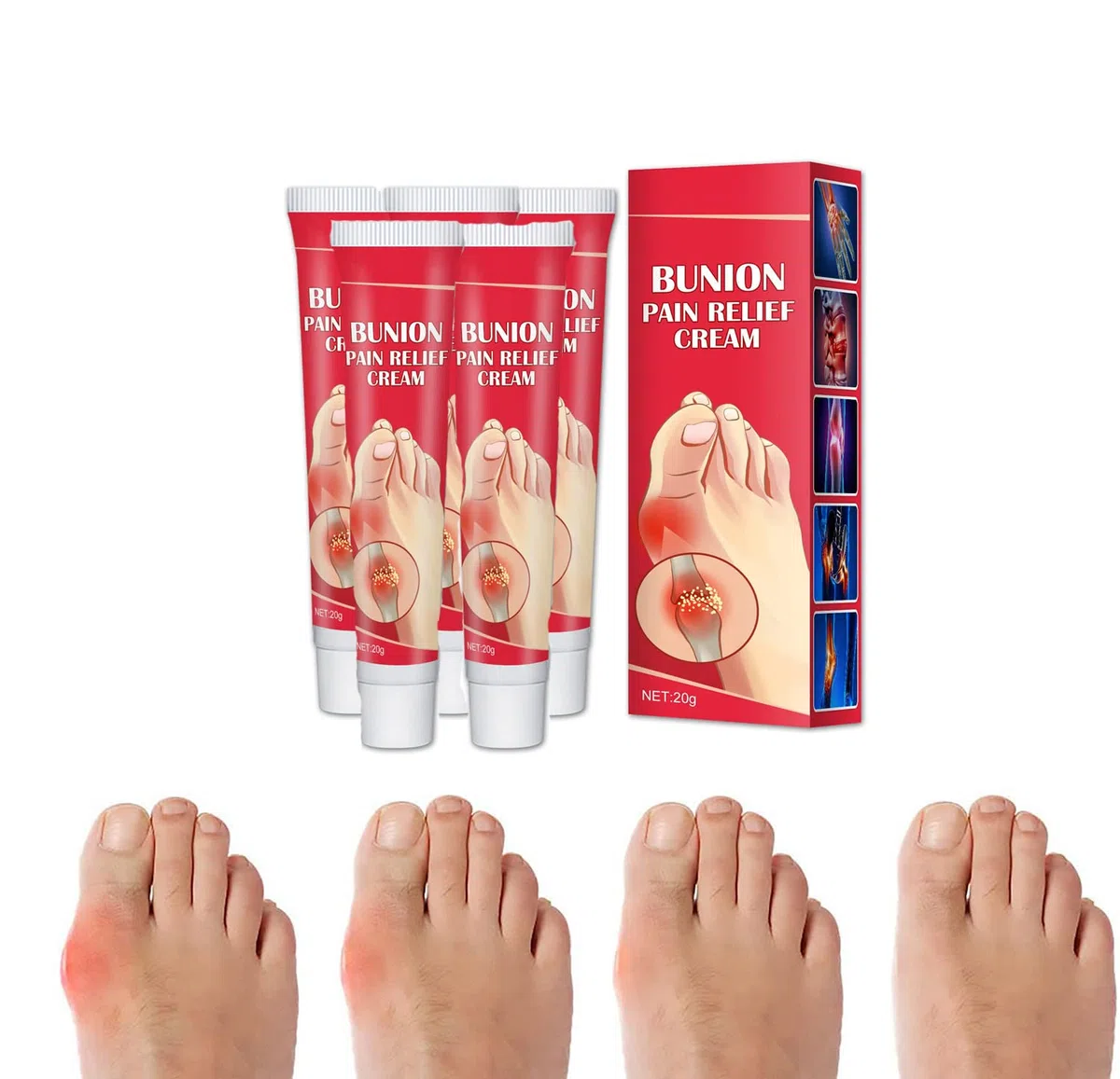5PCS/3PCS Crema para el alivio de la rigidez del dedo del pie del juanete, Crema para el alivio del juanete arqueado para los pies, Alivio del dolor de la artritis tópica (5pcs)