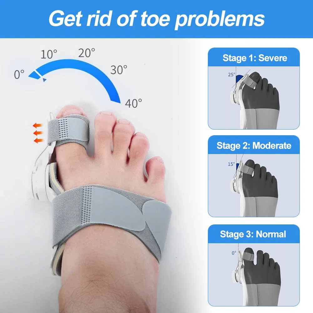 Mineup Corrector de Juanetes, Corrector de Juanetes Pomo Ajustable, Corrección de Hallux Valgus Pomo, Corrección Hallux Valgus para hombres y mujeres