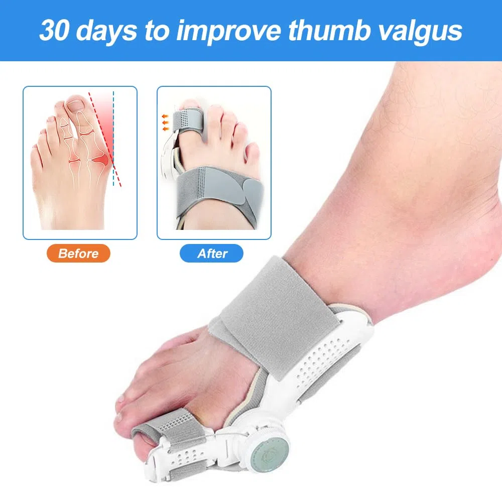Mineup Corrector de Juanetes, Corrector de Juanetes Pomo Ajustable, Corrección de Hallux Valgus Pomo, Corrección Hallux Valgus para hombres y mujeres