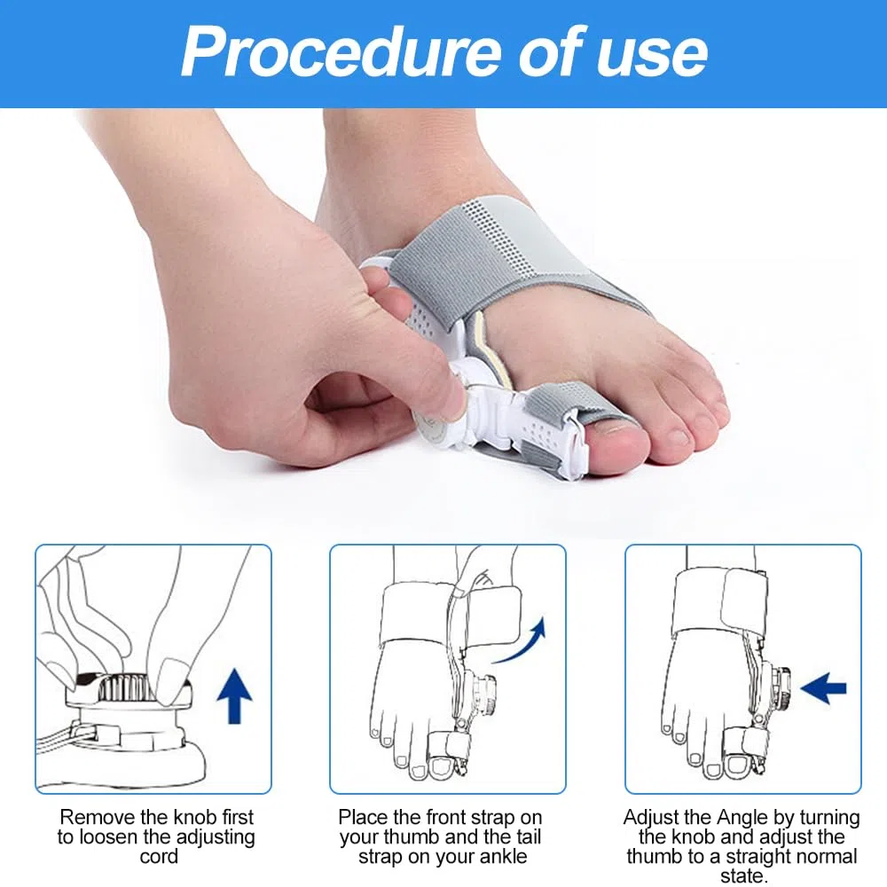 Mineup Corrector de Juanetes, Corrector de Juanetes Pomo Ajustable, Corrección de Hallux Valgus Pomo, Corrección Hallux Valgus para hombres y mujeres